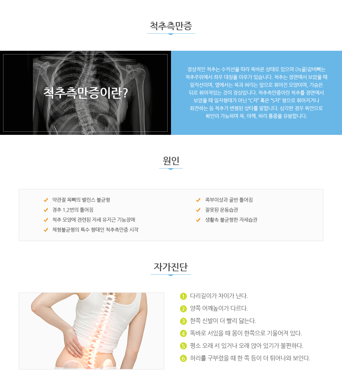 척추측만증